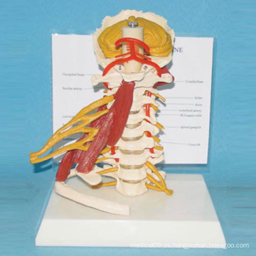 Modelo de columna vertebral cervical natural humano con músculo y nervio